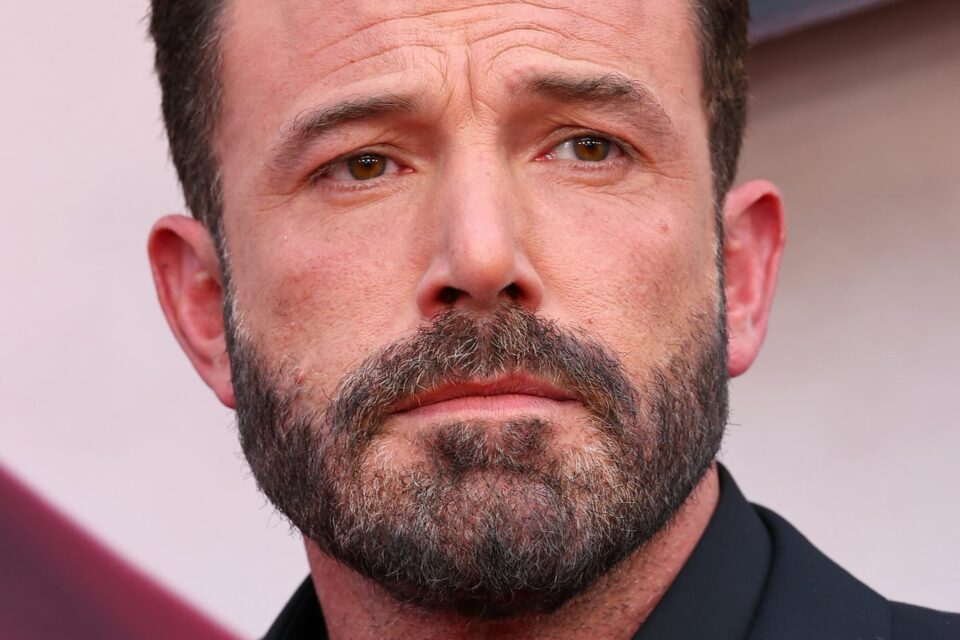 Ben Affleck Has ‘Resting Hard Face,’ Not RBF