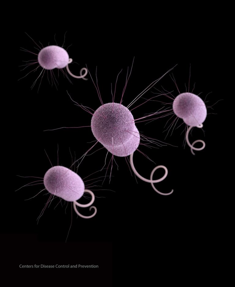 “‘Nightmare Bacteria’ Infections Skyrocket Across the U.S., Sparking Urgent Concern” CDC report says ‘nightmare bacteria’ cases are increasing in U.S. – PBS
